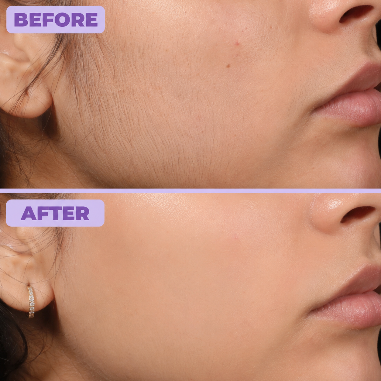 Before and after result