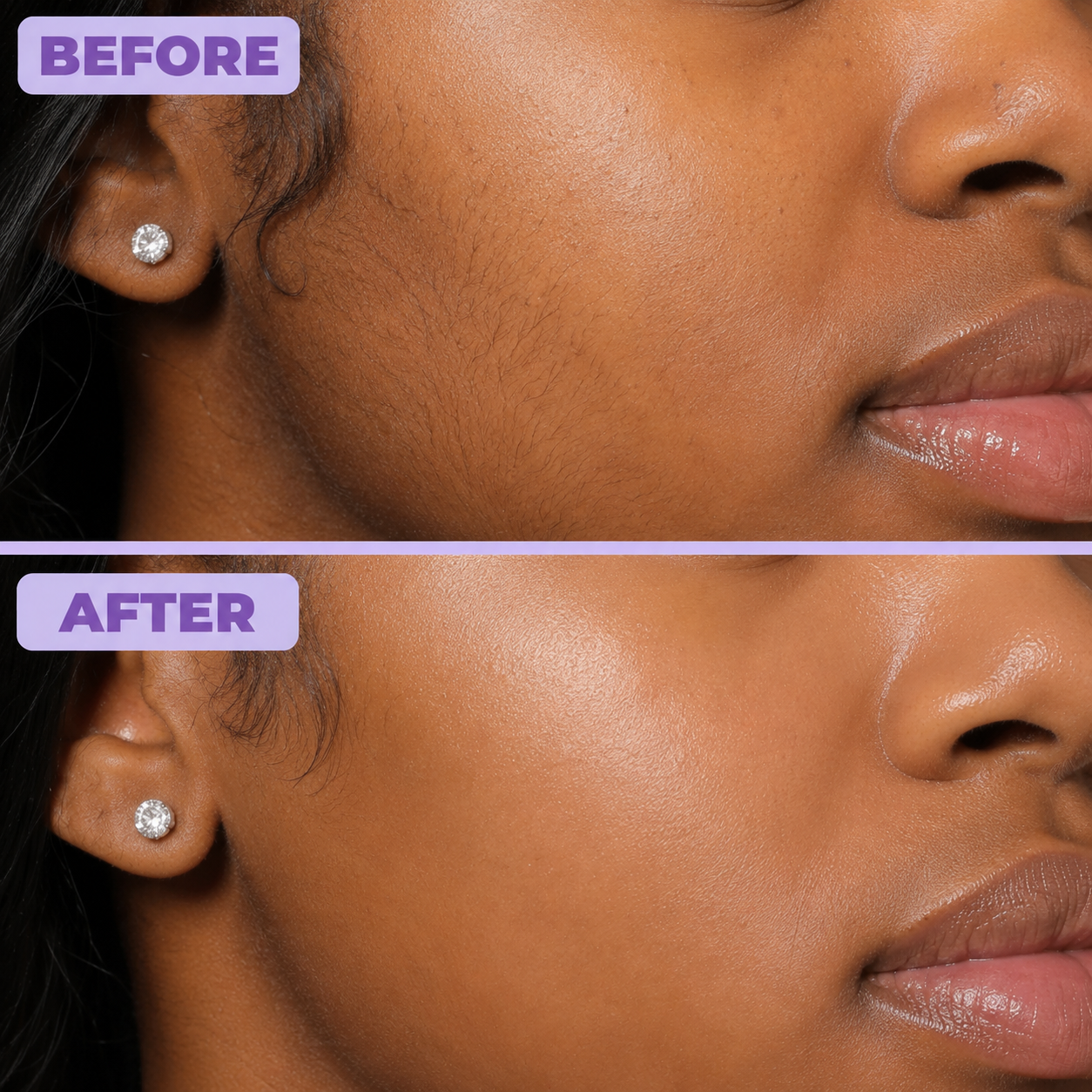 Before and after result